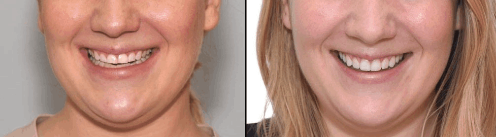 Mobirise